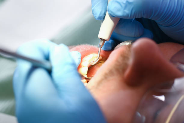 Best Emergency Dental Care for Trauma or Injury in Winner, SD