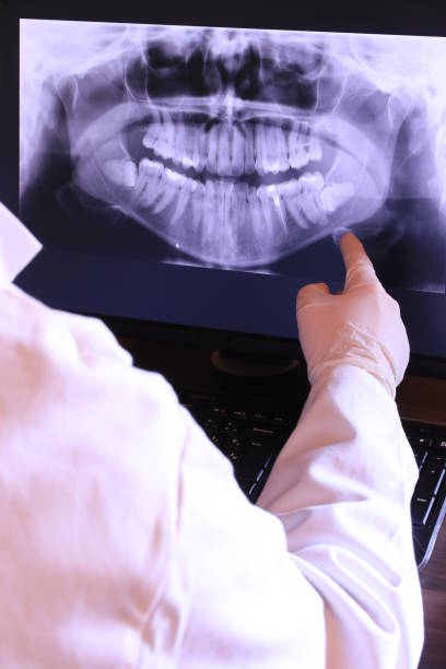 Best Emergency Tooth Extraction in Winner, SD